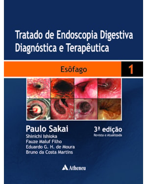 Tratado de endoscopia digestiva diagnóstica e terapêutica: esôfago