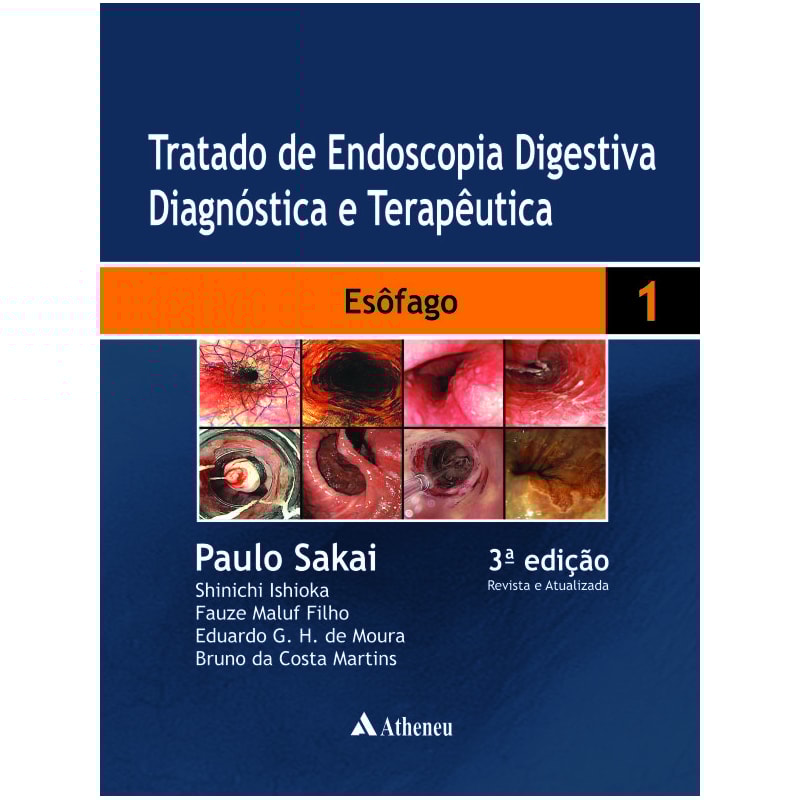 Tratado de endoscopia digestiva diagnóstica e terapêutica: esôfago