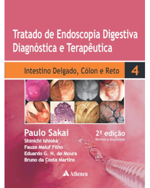Tratado de endoscopia digestiva diagnóstica e terapêutica: intestino delgado, cólon e reto