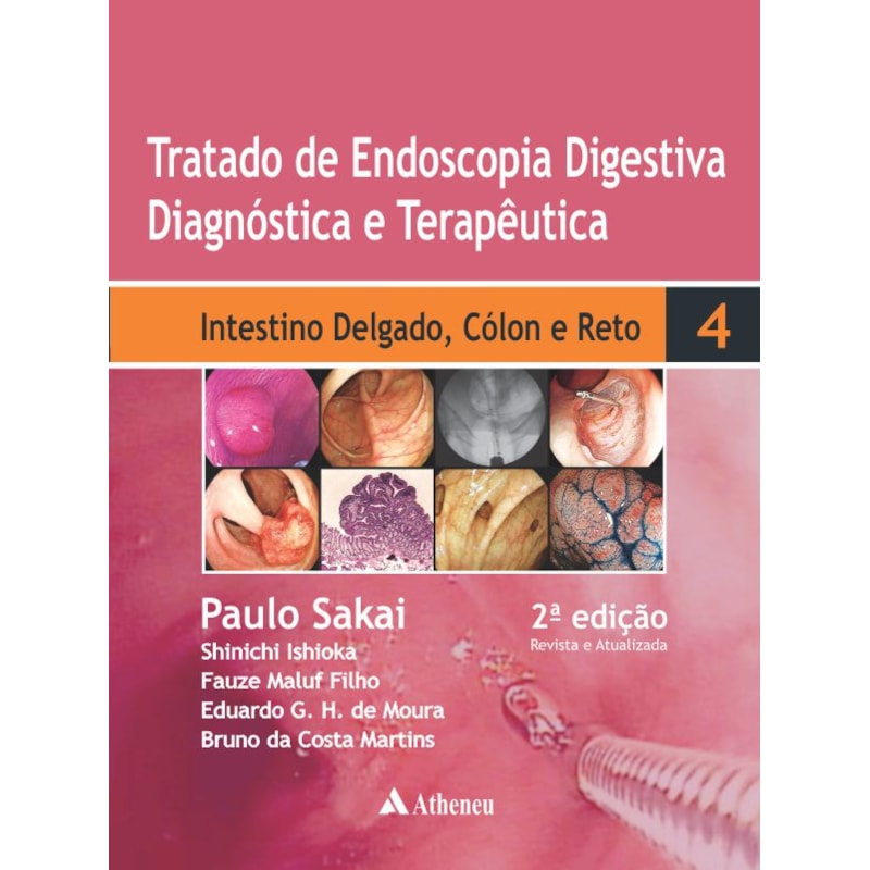 Tratado de endoscopia digestiva diagnóstica e terapêutica: intestino delgado, cólon e reto