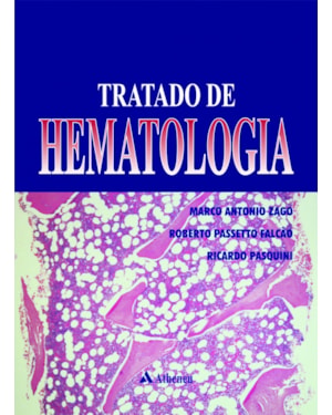 Tratado de hematologia