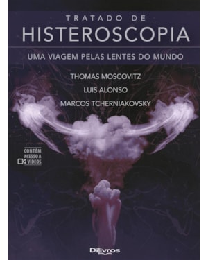 TRATADO DE HISTEROSCOPIA UMA VIAGEM PELAS LENTES DO MUNDO