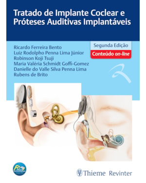 Tratado de implante coclear e próteses auditivas implantáveis