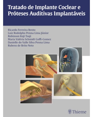 Tratado de implante coclear e próteses auditivas implantáveis