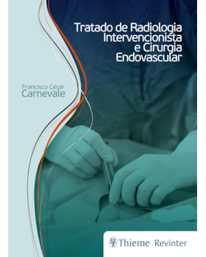 Tratado de Radiologia Intervencionista e Cirurgia Endovascular