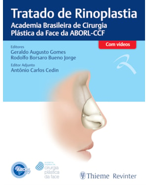 Tratado de rinoplastia: Academia Brasileira de Cirurgia Plástica da Face da ABORL-CCF