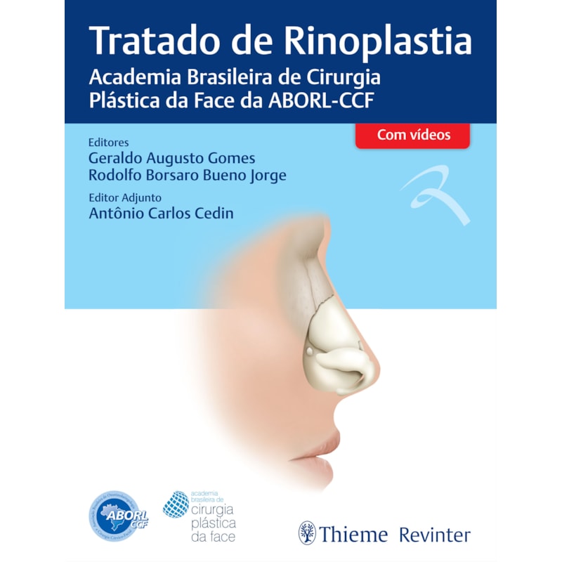 Tratado de rinoplastia: Academia Brasileira de Cirurgia Plástica da Face da ABORL-CCF