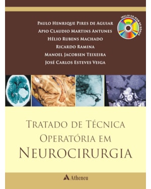 Tratado de técnica operatória em neurocirurgia