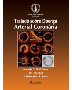 Tratado sobre doença arterial coronária
