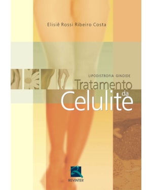 Tratamento da celulite: lipodistrofia ginoide