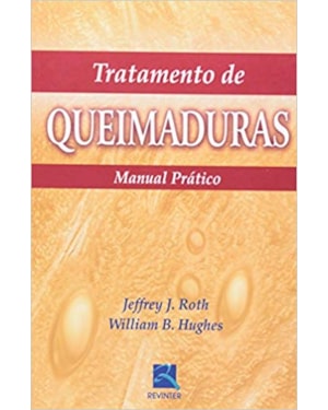 Tratamento de queimaduras: manual prático