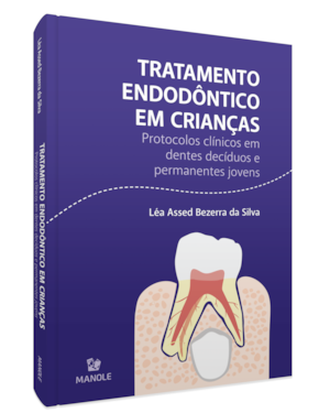 Tratamento endodôntico em crianças: protocolos clínicos em dentes decíduos e permanentes jovens