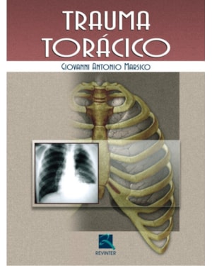 Trauma torácico