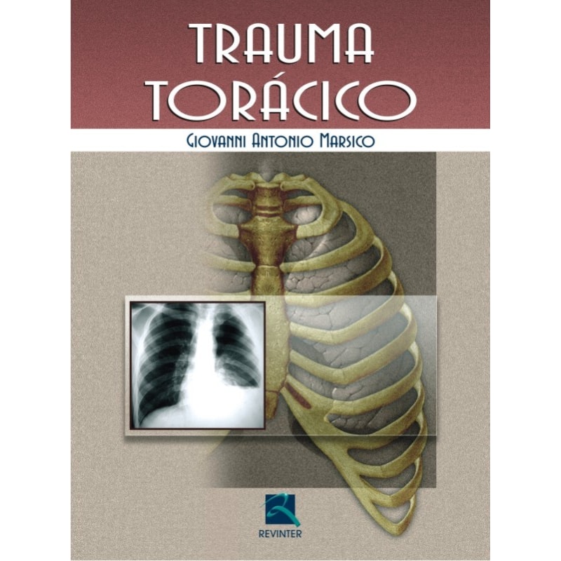 TRAUMA TORÁCICO