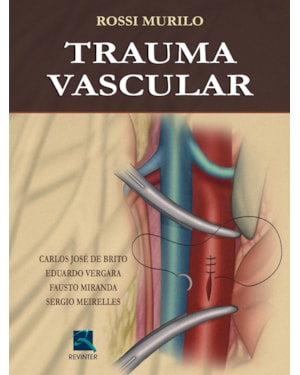 Trauma vascular