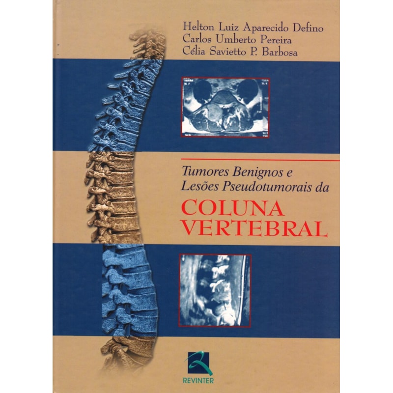 TUMORES BENIGNOS E LESÕES PSEUDOTUMORAIS DA COLUNA VERTEBRAL