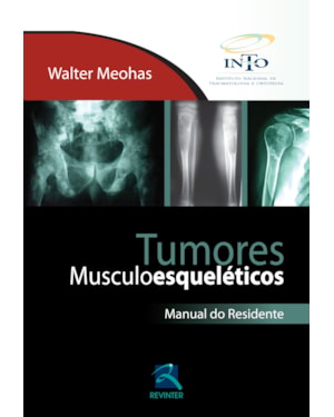 Tumores musculoesqueléticos: manual do residente