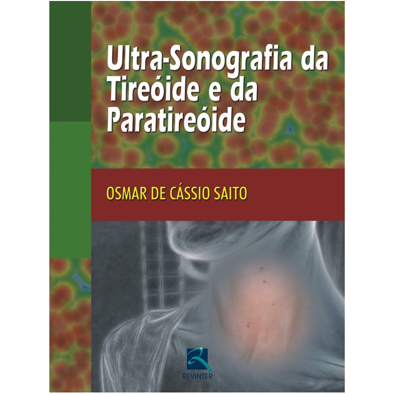 Ultra-sonografia da tireóide e da paratireóide
