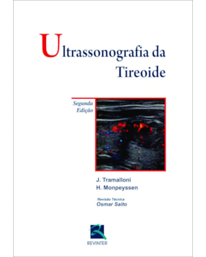 Ultrassonografia da Tireoide