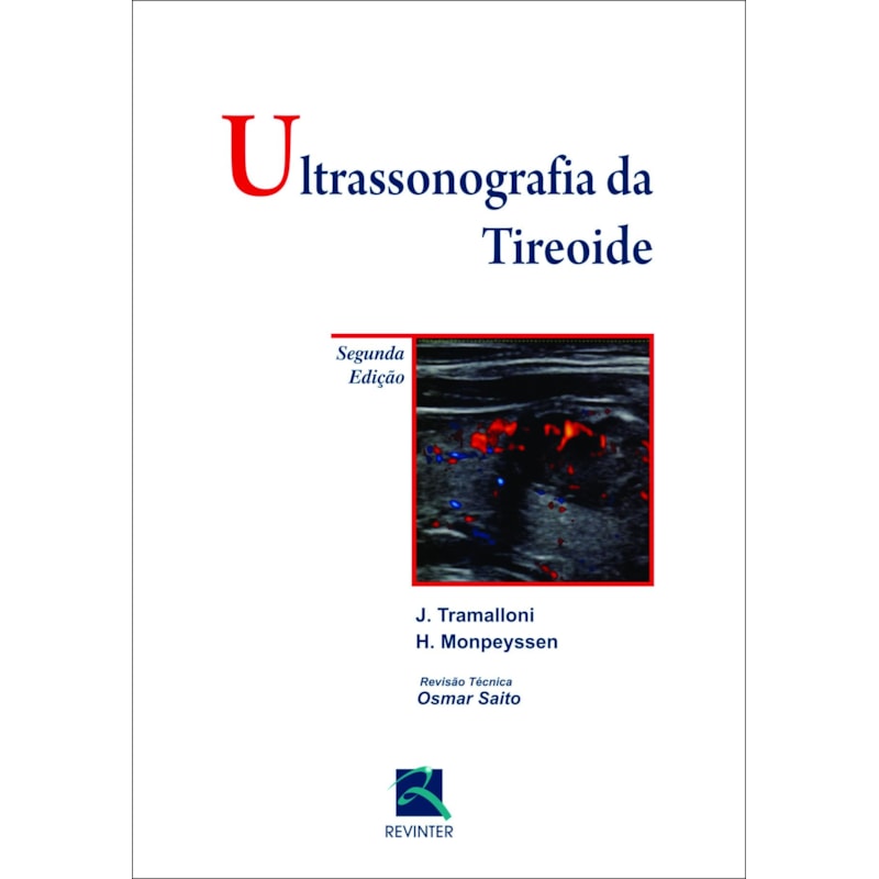 ULTRASSONOGRAFIA DA TIREÓIDE