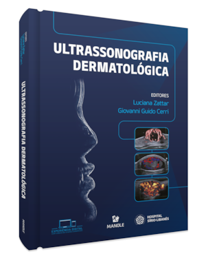 Ultrassonografia dermatológica