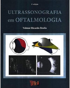 ULTRASSONOGRAFIA EM OFTALMOLOGIA