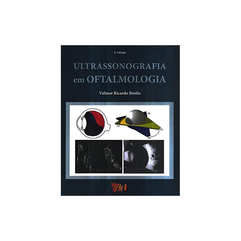 ULTRASSONOGRAFIA EM OFTALMOLOGIA