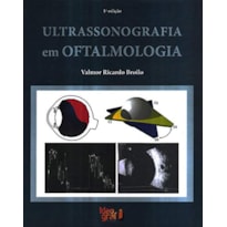ULTRASSONOGRAFIA EM OFTALMOLOGIA ULTRASSONOGRAFIA EM OFTALMOLOGIA