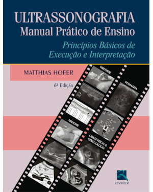 ULTRASSONOGRAFIA: MANUAL PRÁTICO DE ENSINO