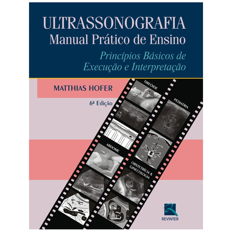 ULTRASSONOGRAFIA: MANUAL PRÁTICO DE ENSINO