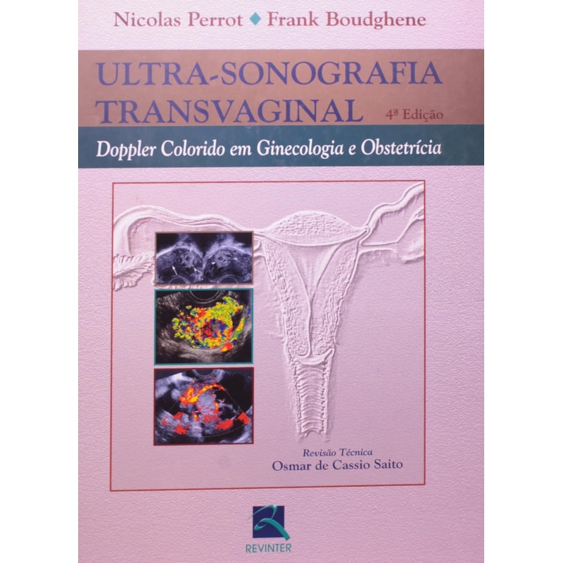 ULTRASSONOGRAFIA TRANSVAGINAL: DOPPLER COLORIDO EM GINECOLOGIA E OBSTETRÍCIA