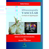 ULTRASSONOGRAFIA VASCULAR