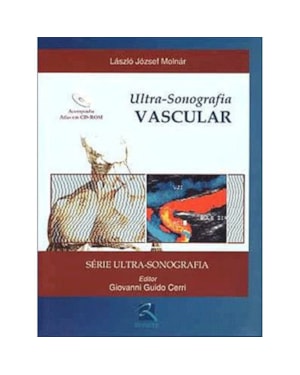 ULTRASSONOGRAFIA VASCULAR