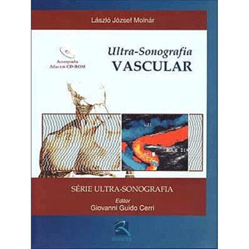 ULTRASSONOGRAFIA VASCULAR