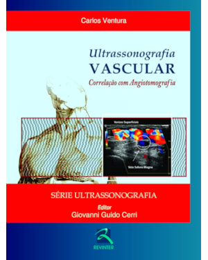Ultrassonografia vascular: correlação com angiotomografia