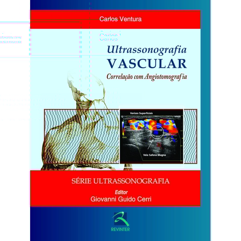 Ultrassonografia vascular: correlação com angiotomografia