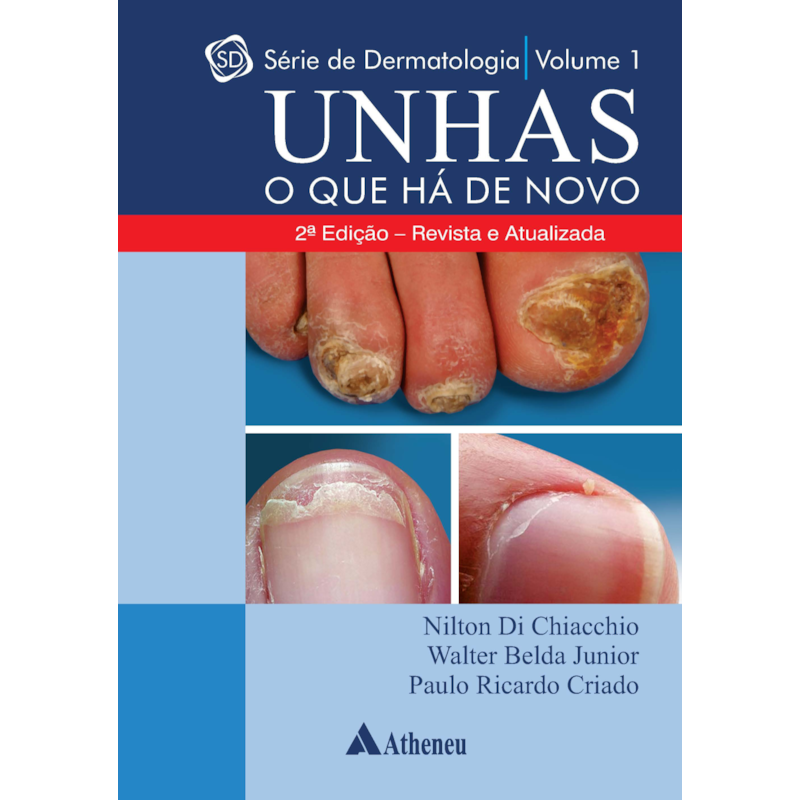 UNHAS O QUE HÁ DE NOVO
