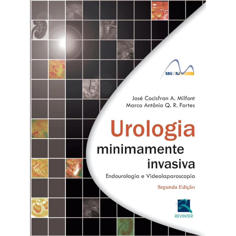 Urologia minimamente invasiva: endourologia e videolaparoscopia