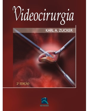 Videocirurgia