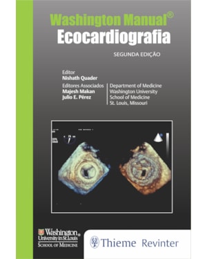 Washington Manual: Ecocardiografia