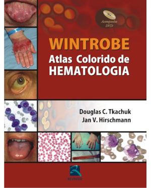 Wintrobe - Atlas colorido de hematologia
